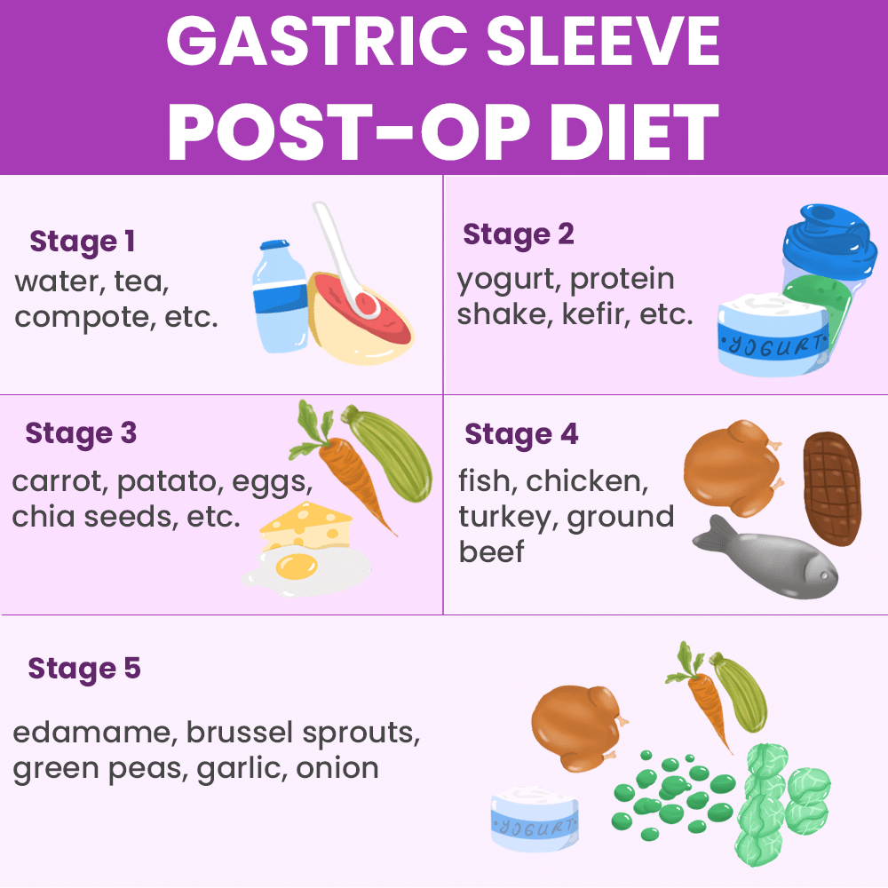 Gastric Sleeve Post op Diet Stages Explained One By One Dr Ceyhun 